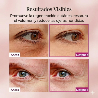 Vitalis - Bálsamo hidratante de colágeno para arrugas
